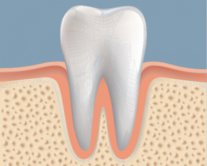bone graft, bone tissue