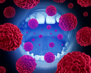oropharyngeal cancer cells